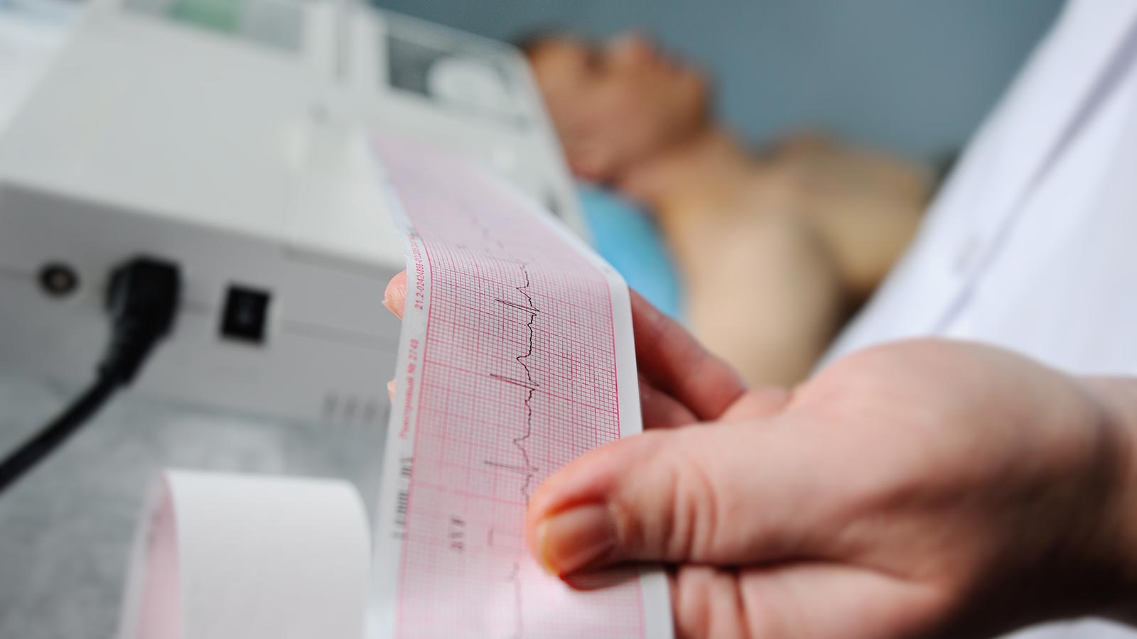 Loperamina alteraciones cardiacas